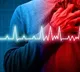 What does a heart attack feel like Survivors share c key points to know