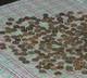 Man suffering from psychiatric disorder swallows 187 coins