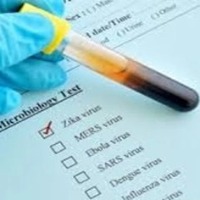 Karnataka on alert as first case of Zika virus surfaces