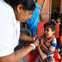 Measles Surge: Country on alert to manage post-pandemic crisis