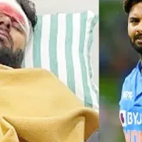 Dehradun Max Hospital releases first official update on Rishabh Pant health after freak car accident