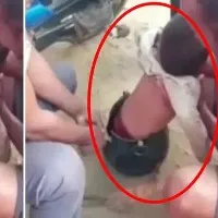 Two Year Old Boy Stuck In A Bowl In Parvatgiri Warangal District Telangana