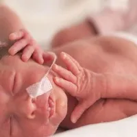 Born at 24 weeks 400gm baby at pune beats all odds