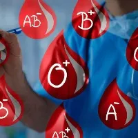 Your blood type may predict risk of stroke before 60