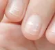 those white spots on your nails are not due to a calcium deficiency