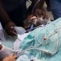 'Taraka Ratna episode highlights need for defibrillator in public places'