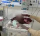 3 Month Old Baby Poked 51 Times With Hot Rod To Treat Pneumonia
