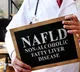 Four symptoms to tell your liver health