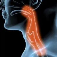 Oesophageal Cancer Risk factors symptoms diagnosis treatment prevention tips