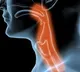 Oesophageal Cancer Risk factors symptoms diagnosis treatment prevention tips