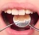 National Toothache Day 2023 5 most common causes of toothache you must know
