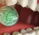 Oral bacteria may increase heart disease risk Research
