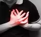 A surge in heart attacks in young people due to covid19