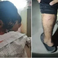 street dog attacks near balanagar in hyderabad