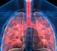 Indians suffers from TB health experts share tips to stay safe