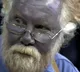 The man who turned blue after taking a dietary supplement for years