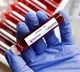 India reports 10753 new Covid cases 27 deaths in past 24 hours