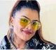 Singer Rakshitha met with road accident in Malaysia