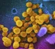 HMPV virus spreading across USA