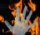 Class 10 student set ablaze by unidentified persons in Andhra