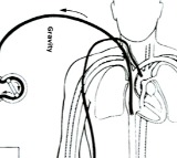 అత్యంత  క్లిష్టమైన సమయంలో రోగి ప్రాణాలు కాపాడిన సిటిజన్స్ స్పెషాలిటీ హాస్పిటల్  వైద్యులు