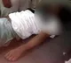 MBBS Student suicide at Kurnool ViswaBharathi Medical College
