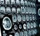 Kerala Teenager Killed By Rare Brain Infection