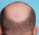groom covered his bald head with a wig relatives crushed to know the truth