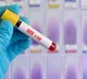 Over 81 pregnant women found HIV positive in 16 months in UP hospital probe ordered
