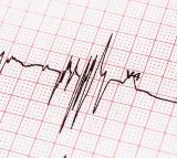 Student dies of cardiac arrest after feeling upset over finishing second in interschool relay race in Karnataka