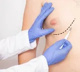 Breast Cancer in men and its symptoms