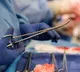 Doctors saves life of a boy who  swallowed 50 magnets in the toy