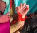 Baby with 26 fingers born in Rajasthan family saying it is goddess incarnation