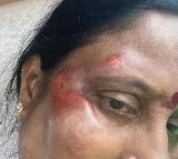 Konda Surekha injured in bike rally