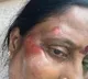 Konda Surekha injured in bike rally