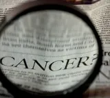 AI tool can estimate cancer patient’s chances for surviving long term