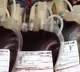 14 children undergoing blood transfusions at UP hospital test positive for Hepatitis, HIV