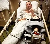 Mark Zuckerberg shares pic from hospital bed after surgery for sparring injury following Elon Musks latest challenge