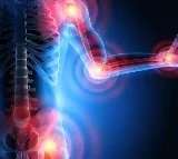 Arthritis should be flagged along with BP and diabetes: Experts