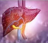 AI offers promise for earlier & accurate liver cancer diagnosis