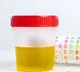 What makes urine yellow researchers finally find out the cause