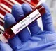 India reports 756 new Covid cases, five deaths