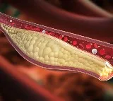 Sclerostin key protein for cardiovascular health in patients with diabetes: Study