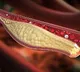 Sclerostin key protein for cardiovascular health in patients with
 diabetes: Study