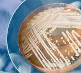 Deadly Fungal Infection Candida Auris Rapidly Spreading In USA