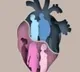 How heart attack symptoms differ in men & women