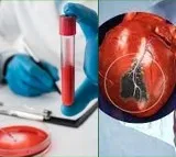 A simple blood test to predict risk of heart attack within six months