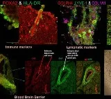 Indian researchers develop 'organoid' to help in neurodegenerative diseases