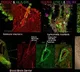 Indian researchers develop 'organoid' to help in neurodegenerative diseases