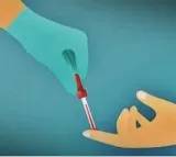 New blood test may quickly diagnose this fatal inflammatory disease